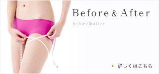 Before&After